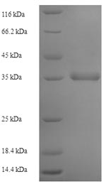 (Tris-Glycine gel) Discontinuous SDS-PAGE (reduced) with 5% enrichment gel and 15% separation gel. (Tris-Glycine gel) Discontinuous SDS-PAGE (reduced) with 5% enrichment gel and 15% separation gel.