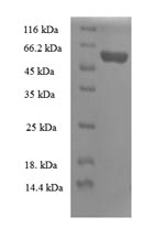 (Tris-Glycine gel) Discontinuous SDS-PAGE (reduced) with 5% enrichment gel and 15% separation gel. (Tris-Glycine gel) Discontinuous SDS-PAGE (reduced) with 5% enrichment gel and 15% separation gel.