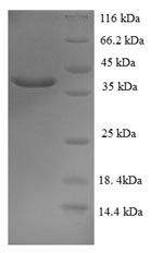 (Tris-Glycine gel) Discontinuous SDS-PAGE (reduced) with 5% enrichment gel and 15% separation gel. (Tris-Glycine gel) Discontinuous SDS-PAGE (reduced) with 5% enrichment gel and 15% separation gel.