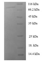 (Tris-Glycine gel) Discontinuous SDS-PAGE (reduced) with 5% enrichment gel and 15% separation gel. (Tris-Glycine gel) Discontinuous SDS-PAGE (reduced) with 5% enrichment gel and 15% separation gel.