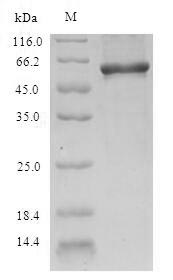 SDS-PAGE- Recombinant protein Human NAPRT1
