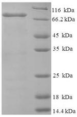 SDS-PAGE- Recombinant protein Human NDST1
