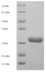 (Tris-Glycine gel) Discontinuous SDS-PAGE (reduced) with 5% enrichment gel and 15% separation gel. (Tris-Glycine gel) Discontinuous SDS-PAGE (reduced) with 5% enrichment gel and 15% separation gel.