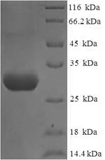 (Tris-Glycine gel) Discontinuous SDS-PAGE (reduced) with 5% enrichment gel and 15% separation gel. (Tris-Glycine gel) Discontinuous SDS-PAGE (reduced) with 5% enrichment gel and 15% separation gel.