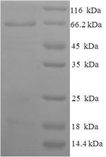 SDS-PAGE- Recombinant protein Human NPR1