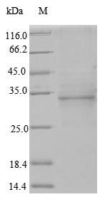 (Tris-Glycine gel) Discontinuous SDS-PAGE (reduced) with 5% enrichment gel and 15% separation gel.