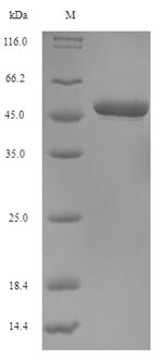 (Tris-Glycine gel) Discontinuous SDS-PAGE (reduced) with 5% enrichment gel and 15% separation gel. (Tris-Glycine gel) Discontinuous SDS-PAGE (reduced) with 5% enrichment gel and 15% separation gel.
