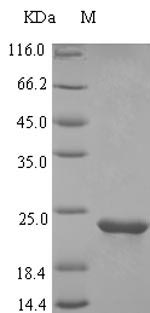(Tris-Glycine gel) Discontinuous SDS-PAGE (reduced) with 5% enrichment gel and 15% separation gel. (Tris-Glycine gel) Discontinuous SDS-PAGE (reduced) with 5% enrichment gel and 15% separation gel.