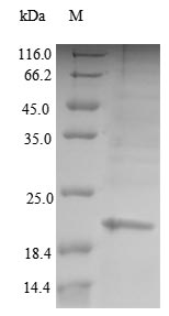 (Tris-Glycine gel) Discontinuous SDS-PAGE (reduced) with 5% enrichment gel and 15% separation gel. (Tris-Glycine gel) Discontinuous SDS-PAGE (reduced) with 5% enrichment gel and 15% separation gel.