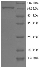 (Tris-Glycine gel) Discontinuous SDS-PAGE (reduced) with 5% enrichment gel and 15% separation gel.