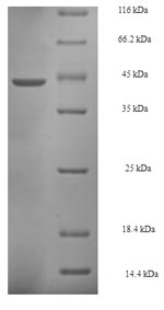 (Tris-Glycine gel) Discontinuous SDS-PAGE (reduced) with 5% enrichment gel and 15% separation gel.