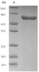 (Tris-Glycine gel) Discontinuous SDS-PAGE (reduced) with 5% enrichment gel and 15% separation gel. (Tris-Glycine gel) Discontinuous SDS-PAGE (reduced) with 5% enrichment gel and 15% separation gel.