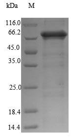(Tris-Glycine gel) Discontinuous SDS-PAGE (reduced) with 5% enrichment gel and 15% separation gel. (Tris-Glycine gel) Discontinuous SDS-PAGE (reduced) with 5% enrichment gel and 15% separation gel.