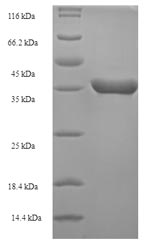 (Tris-Glycine gel) Discontinuous SDS-PAGE (reduced) with 5% enrichment gel and 15% separation gel.
