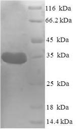 (Tris-Glycine gel) Discontinuous SDS-PAGE (reduced) with 5% enrichment gel and 15% separation gel.