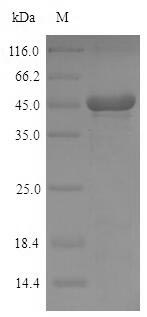 (Tris-Glycine gel) Discontinuous SDS-PAGE (reduced) with 5% enrichment gel and 15% separation gel. (Tris-Glycine gel) Discontinuous SDS-PAGE (reduced) with 5% enrichment gel and 15% separation gel.