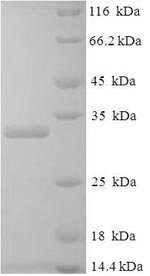 SDS-PAGE- Recombinant protein Human PGF