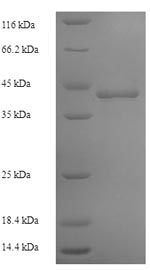 (Tris-Glycine gel) Discontinuous SDS-PAGE (reduced) with 5% enrichment gel and 15% separation gel. (Tris-Glycine gel) Discontinuous SDS-PAGE (reduced) with 5% enrichment gel and 15% separation gel.