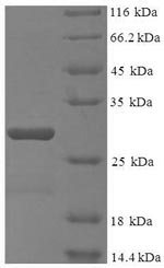 (Tris-Glycine gel) Discontinuous SDS-PAGE (reduced) with 5% enrichment gel and 15% separation gel. (Tris-Glycine gel) Discontinuous SDS-PAGE (reduced) with 5% enrichment gel and 15% separation gel.