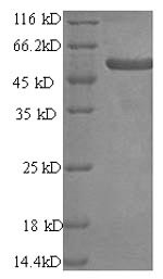(Tris-Glycine gel) Discontinuous SDS-PAGE (reduced) with 5% enrichment gel and 15% separation gel. (Tris-Glycine gel) Discontinuous SDS-PAGE (reduced) with 5% enrichment gel and 15% separation gel.