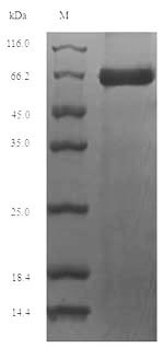 (Tris-Glycine gel) Discontinuous SDS-PAGE (reduced) with 5% enrichment gel and 15% separation gel. (Tris-Glycine gel) Discontinuous SDS-PAGE (reduced) with 5% enrichment gel and 15% separation gel.