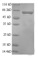 (Tris-Glycine gel) Discontinuous SDS-PAGE (reduced) with 5% enrichment gel and 15% separation gel. (Tris-Glycine gel) Discontinuous SDS-PAGE (reduced) with 5% enrichment gel and 15% separation gel.