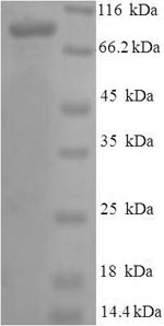 SDS-PAGE- Recombinant protein Human PROS1