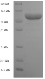 (Tris-Glycine gel) Discontinuous SDS-PAGE (reduced) with 5% enrichment gel and 15% separation gel. (Tris-Glycine gel) Discontinuous SDS-PAGE (reduced) with 5% enrichment gel and 15% separation gel.