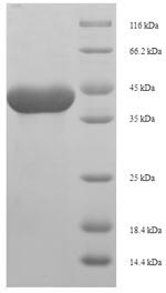 (Tris-Glycine gel) Discontinuous SDS-PAGE (reduced) with 5% enrichment gel and 15% separation gel. (Tris-Glycine gel) Discontinuous SDS-PAGE (reduced) with 5% enrichment gel and 15% separation gel.