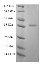 (Tris-Glycine gel) Discontinuous SDS-PAGE (reduced) with 5% enrichment gel and 15% separation gel. (Tris-Glycine gel) Discontinuous SDS-PAGE (reduced) with 5% enrichment gel and 15% separation gel.