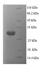 (Tris-Glycine gel) Discontinuous SDS-PAGE (reduced) with 5% enrichment gel and 15% separation gel. (Tris-Glycine gel) Discontinuous SDS-PAGE (reduced) with 5% enrichment gel and 15% separation gel.