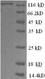 (Tris-Glycine gel) Discontinuous SDS-PAGE (reduced) with 5% enrichment gel and 15% separation gel. (Tris-Glycine gel) Discontinuous SDS-PAGE (reduced) with 5% enrichment gel and 15% separation gel.