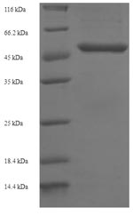 (Tris-Glycine gel) Discontinuous SDS-PAGE (reduced) with 5% enrichment gel and 15% separation gel. (Tris-Glycine gel) Discontinuous SDS-PAGE (reduced) with 5% enrichment gel and 15% separation gel.
