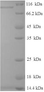 CSB-EP019284HU SDS-PAGE