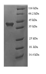 (Tris-Glycine gel) Discontinuous SDS-PAGE (reduced) with 5% enrichment gel and 15% separation gel.