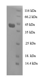 (Tris-Glycine gel) Discontinuous SDS-PAGE (reduced) with 5% enrichment gel and 15% separation gel. (Tris-Glycine gel) Discontinuous SDS-PAGE (reduced) with 5% enrichment gel and 15% separation gel.