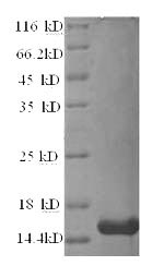 (Tris-Glycine gel) Discontinuous SDS-PAGE (reduced) with 5% enrichment gel and 15% separation gel. (Tris-Glycine gel) Discontinuous SDS-PAGE (reduced) with 5% enrichment gel and 15% separation gel.