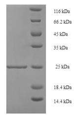 SDS-PAGE- Recombinant protein Human RETN