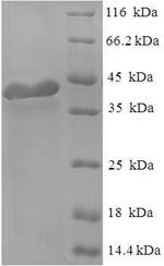 (Tris-Glycine gel) Discontinuous SDS-PAGE (reduced) with 5% enrichment gel and 15% separation gel. (Tris-Glycine gel) Discontinuous SDS-PAGE (reduced) with 5% enrichment gel and 15% separation gel.