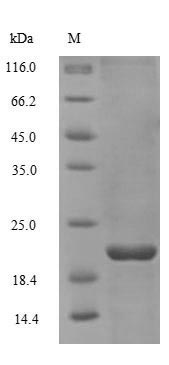 (Tris-Glycine gel) Discontinuous SDS-PAGE (reduced) with 5% enrichment gel and 15% separation gel. (Tris-Glycine gel) Discontinuous SDS-PAGE (reduced) with 5% enrichment gel and 15% separation gel.