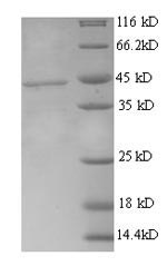 SDS-PAGE- Recombinant protein Human ROR1