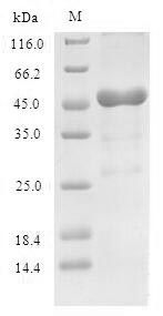 (Tris-Glycine gel) Discontinuous SDS-PAGE (reduced) with 5% enrichment gel and 15% separation gel. (Tris-Glycine gel) Discontinuous SDS-PAGE (reduced) with 5% enrichment gel and 15% separation gel.