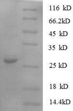 (Tris-Glycine gel) Discontinuous SDS-PAGE (reduced) with 5% enrichment gel and 15% separation gel. (Tris-Glycine gel) Discontinuous SDS-PAGE (reduced) with 5% enrichment gel and 15% separation gel.