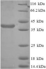 SDS-PAGE- Recombinant protein Human SCO2