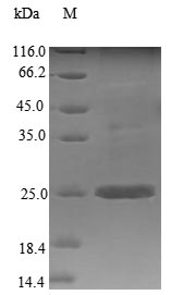 (Tris-Glycine gel) Discontinuous SDS-PAGE (reduced) with 5% enrichment gel and 15% separation gel. (Tris-Glycine gel) Discontinuous SDS-PAGE (reduced) with 5% enrichment gel and 15% separation gel.