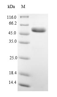 (Tris-Glycine gel) Discontinuous SDS-PAGE (reduced) with 5% enrichment gel and 15% separation gel. (Tris-Glycine gel) Discontinuous SDS-PAGE (reduced) with 5% enrichment gel and 15% separation gel.