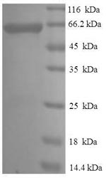 (Tris-Glycine gel) Discontinuous SDS-PAGE (reduced) with 5% enrichment gel and 15% separation gel. (Tris-Glycine gel) Discontinuous SDS-PAGE (reduced) with 5% enrichment gel and 15% separation gel.