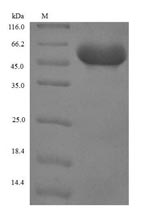 (Tris-Glycine gel) Discontinuous SDS-PAGE (reduced) with 5% enrichment gel and 15% separation gel. (Tris-Glycine gel) Discontinuous SDS-PAGE (reduced) with 5% enrichment gel and 15% separation gel.
