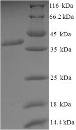 SDS-PAGE- Recombinant protein Mouse Slc1a2