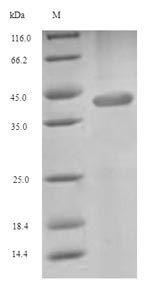 (Tris-Glycine gel) Discontinuous SDS-PAGE (reduced) with 5% enrichment gel and 15% separation gel. (Tris-Glycine gel) Discontinuous SDS-PAGE (reduced) with 5% enrichment gel and 15% separation gel.